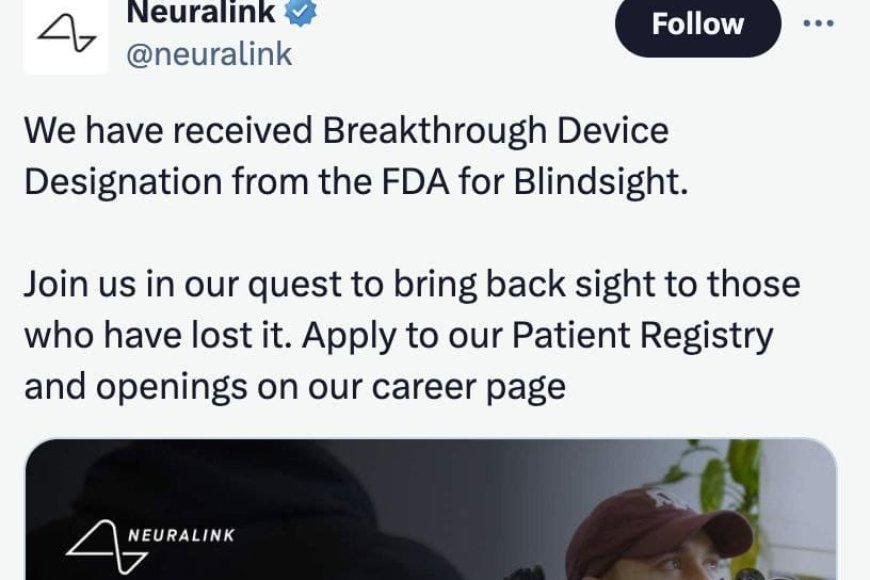 Neuralink Илона Маска начнёт тестировать имплант для восстановления зрения у людей