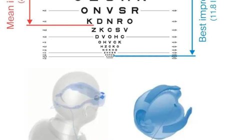 Scientists have developed a chip to restore vision in people with vision loss