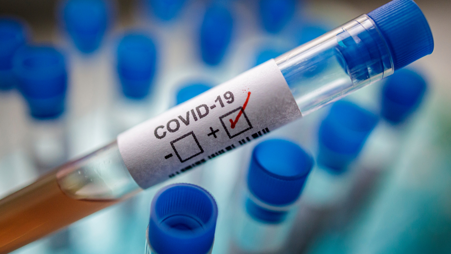 Барлығы қауіпсіз болса, неге мұндай шаралар? Вакцина өндірушілеріне ұзартылған заңды қорғаныс берілді